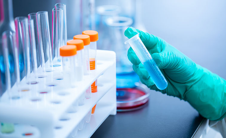 تستخدم أنابيب الطرد المركزي MDHC على نطاق واسع في المختبرات لأغراض متعددة ، من تخزين العينات إلى الطرد المركزي عالي السرعة